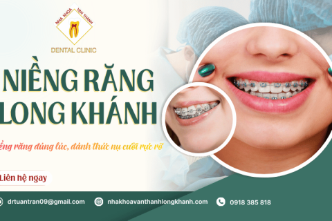 Cẩm nang niềng răng Long Khánh từ A-Z: Bí quyết cho nụ cười rạng ngời
